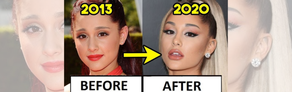 Ariana Grande’s Before and After Plastic Surgery Journey