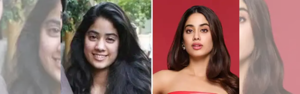 Janhvi Kapoor’s remarkable transformation and plastic surgery